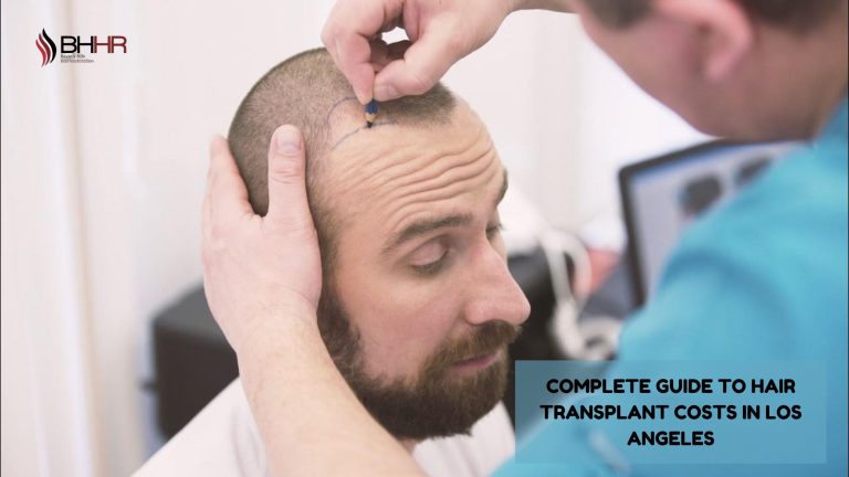 hair transplant los angeles cost